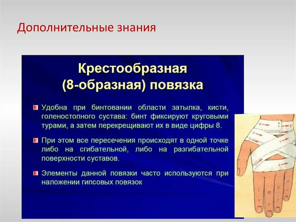 Крестообразную повязку применяют при повреждении
