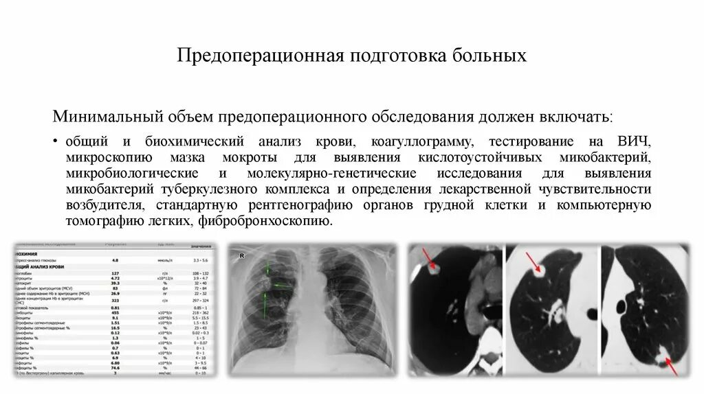 Комиссия при туберкулезе. Анализы при туберкулезе легких. Анализ крови при туберкулезе. Изменения в крови при туберкулезе. Анализы больного туберкулезом.