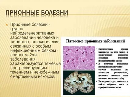 Побежденные болезни человечества