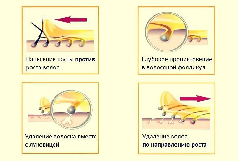 Схема нанесения сахарной пасты. Схемы нанесения пасты для шугаринга. Шугаринг по росту волос. Направление роста волос для депиляции. Депиляция воском против роста или по росту