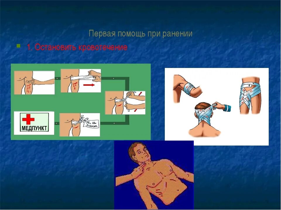 Оказание первой медицинской помощи при ранах. Этапы оказания первой медицинской помощи при ранениях. 1 медицинская помощь при ранении