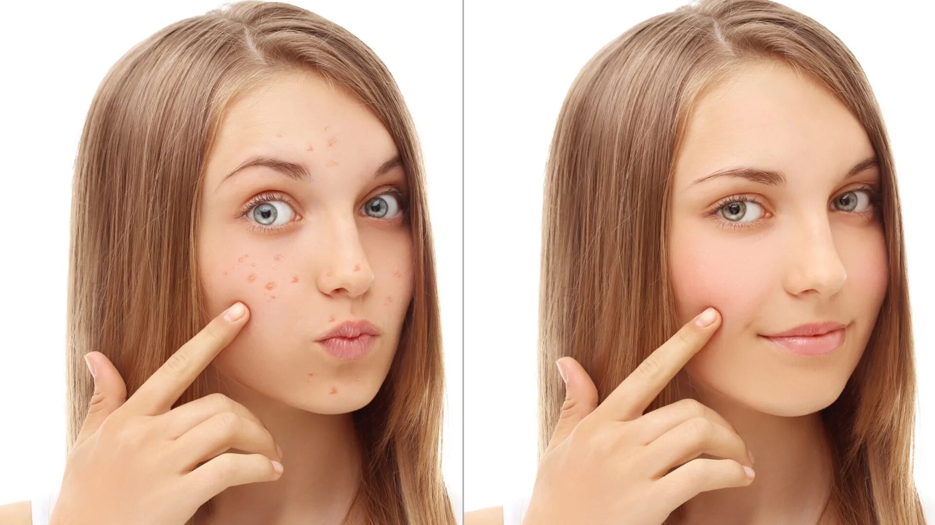 Example face