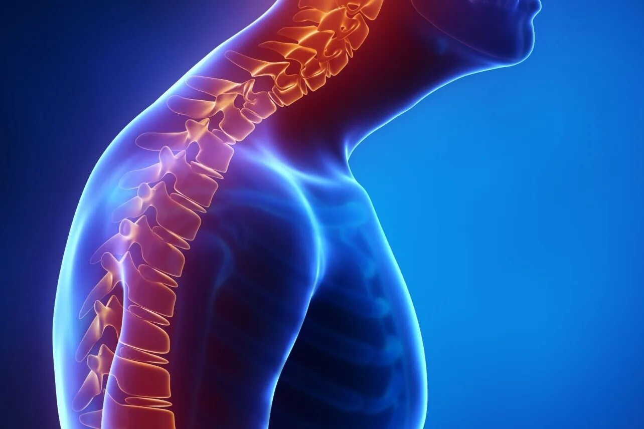 Остеохондроз позвоночника клиника симптомы. Остеохондроз причины возникновения. Остеохондроз. Грудной отдел позвоночника аритмия. Грудной отдел позвоночника аритмия.