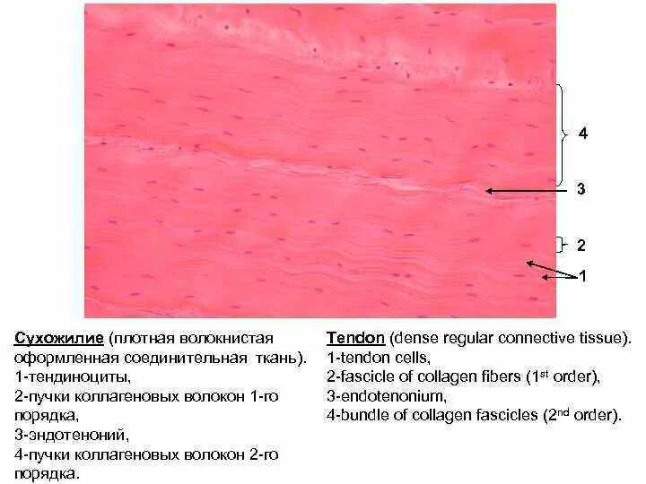 Плотная оформленная ткань. Плотная оформленная соединительная ткань препарат. Плотная волокнистая оформленная соединительная ткань гистология. Плотная соединительная ткань сухожилия препарат. Плотная волокнистая соединительная ткань препарат.