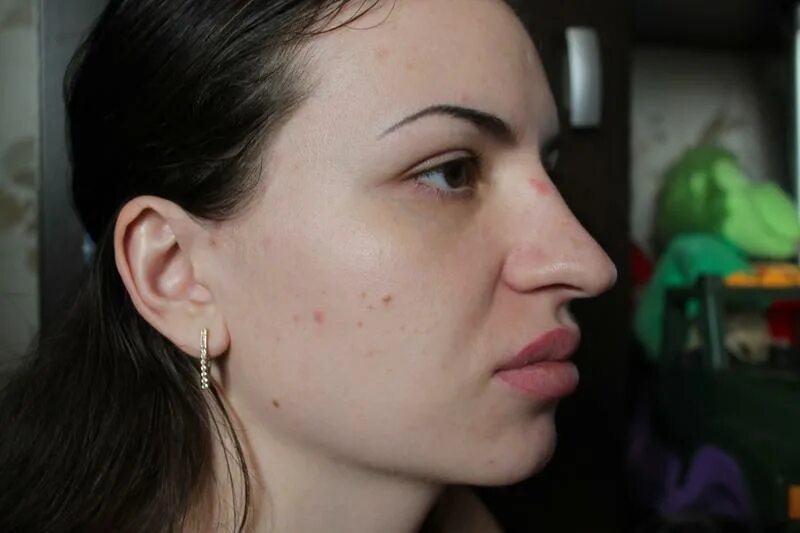 сон страшный нос