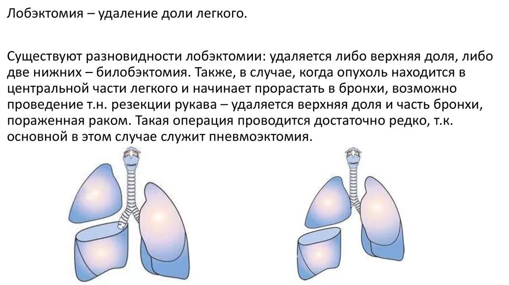 После лобэктомии легкого. Лобэктомия верхней доли правого легкого операция. Лобэктомия средней доли правого легкого.