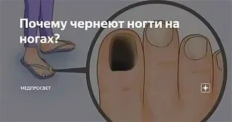 Почему быстро чернеет