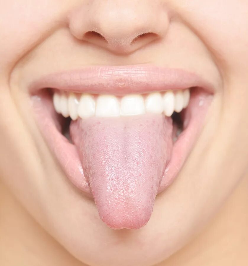 Как должен выглядеть язычок. Как должен выглядеть язычок. Как должен выглядеть язычок. Как должен выглядеть язычок. Заболевания по цвету языка.