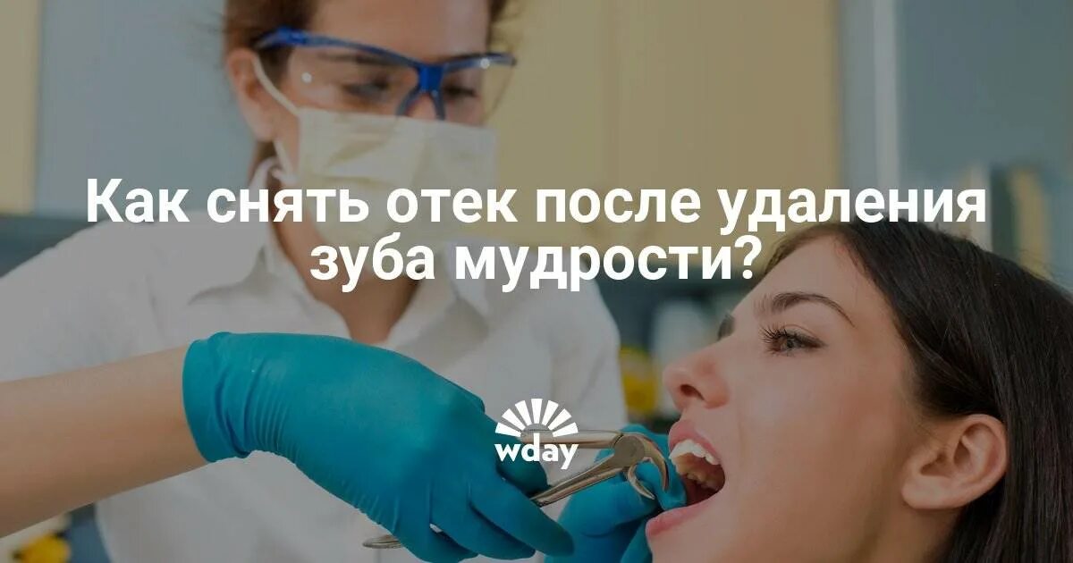 Как снять опухоль после удаления зуба