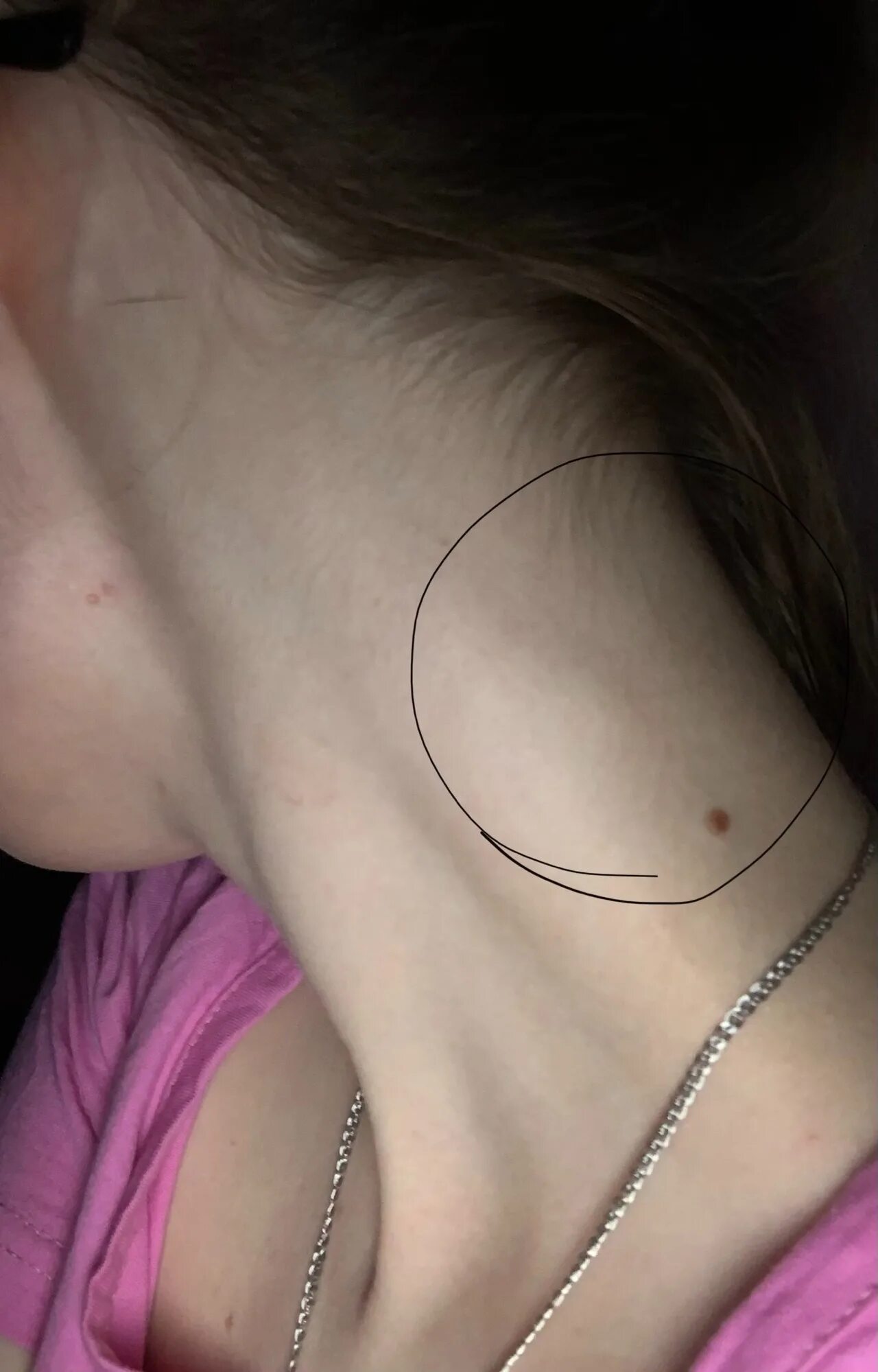 Как выглядит лимфоузел у детей Pin on Add Your KW Here or Brand Name