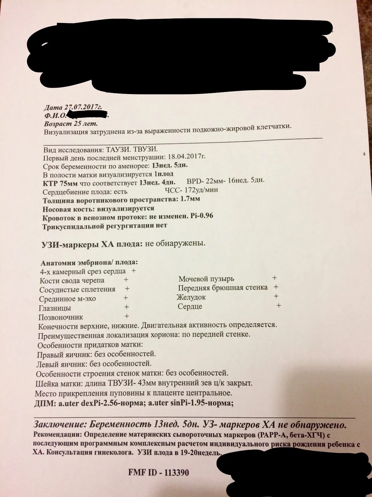 Сердце визуализация затруднена