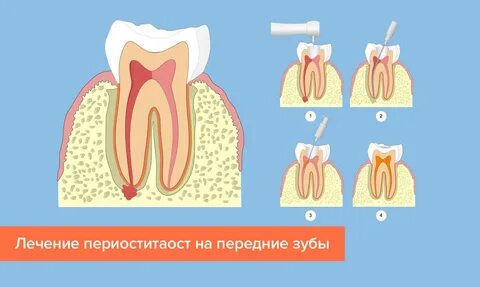 Онемели зубы почему