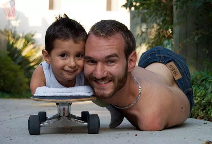 Без рук и ног ник вуйчич. Ник вуйчич оратор. Оскар писториус. Инвалид без рук и ног ник вуйчич. Синдром тетраамелии ник вуйчич.