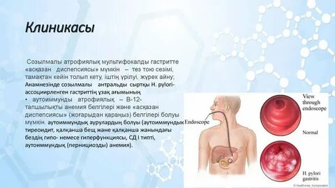 Сочиде жақын кездесулер іздейді