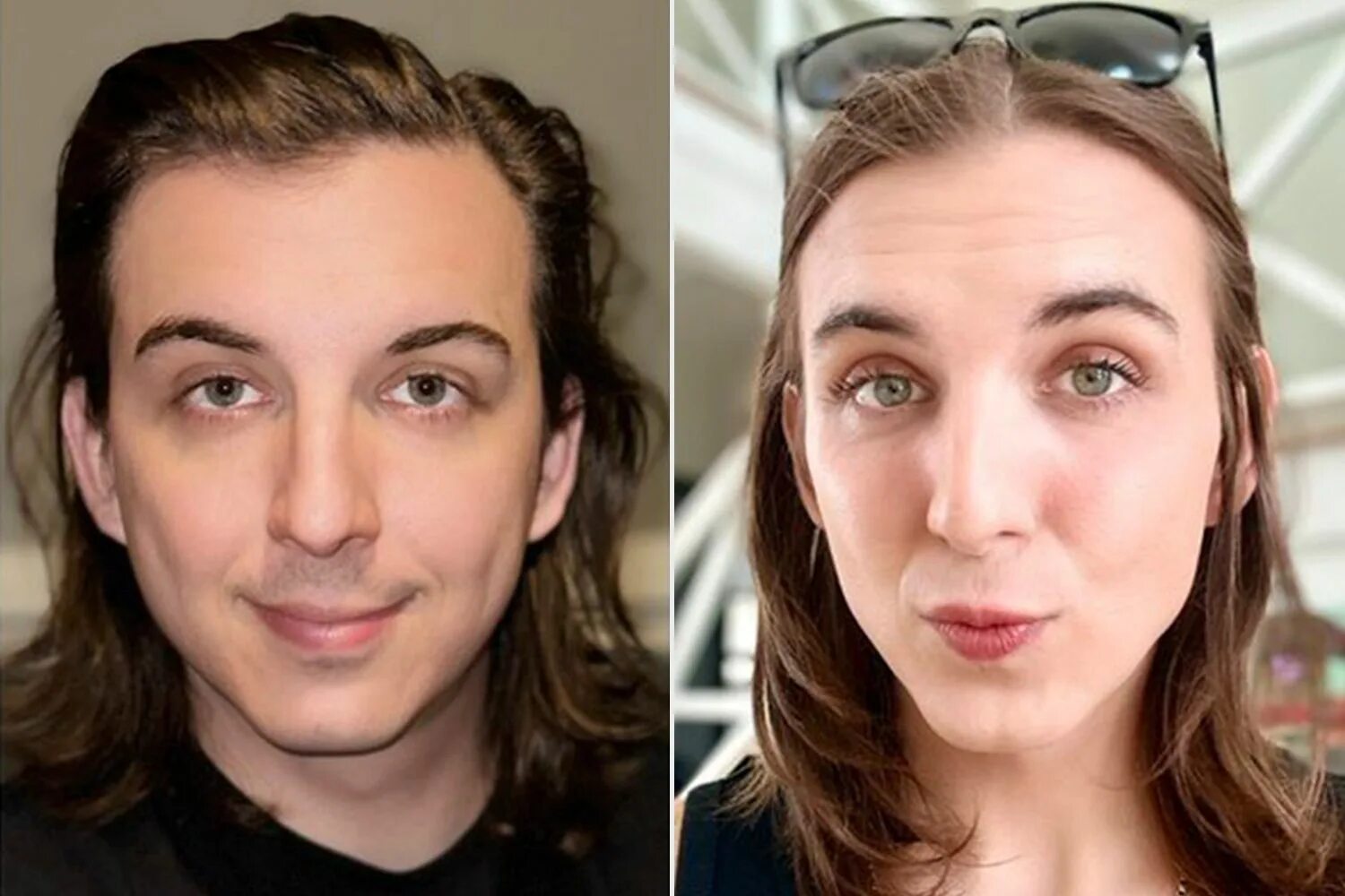 MTF HRT 6 months. Гормонотерапия транссексуальности. Мистер бист трансгендер