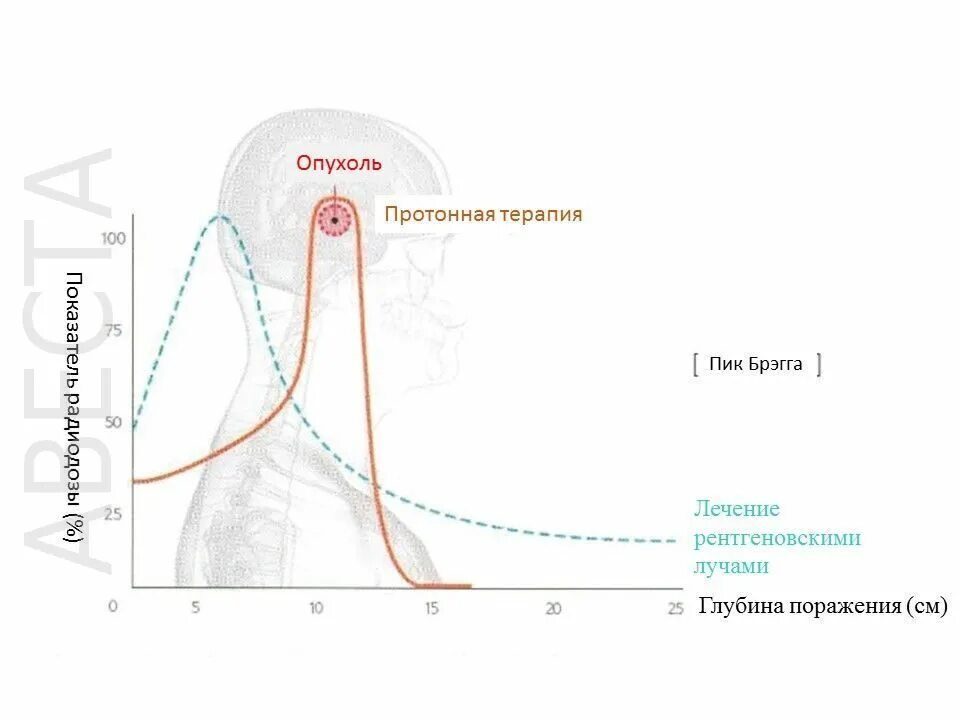 Протонная терапия рака. Кривая Брэгга. Пик Брэгга. Пик Брэгга для Альфа частиц. Пик Брэгга протоны.