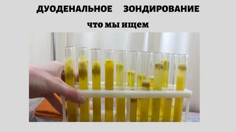 Цвет желчи в норме