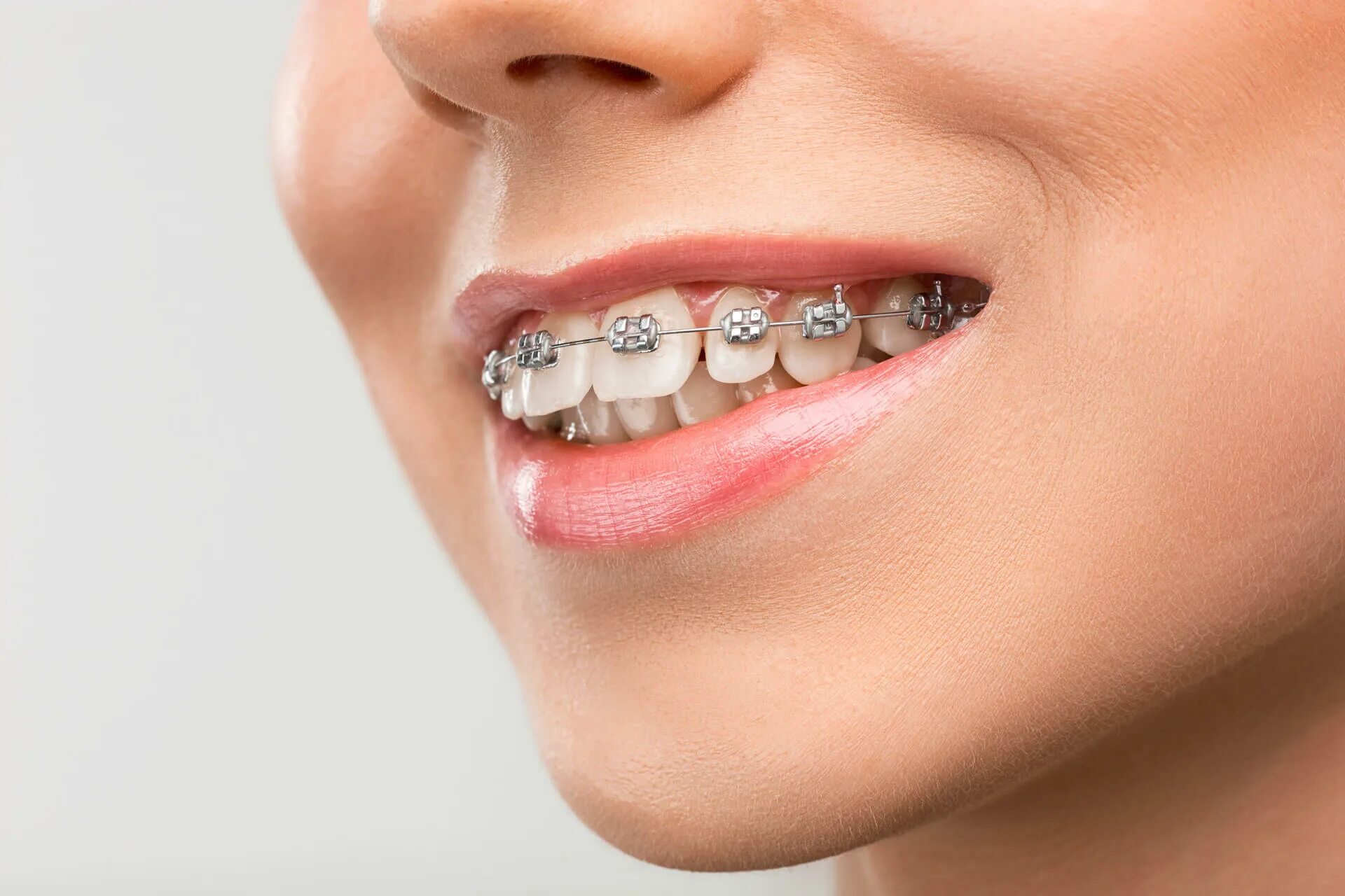 Matching brackets. Matching brackets