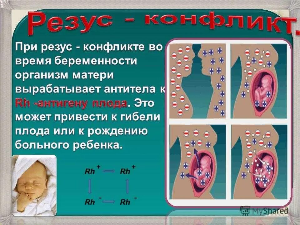 Укол при резус конфликте