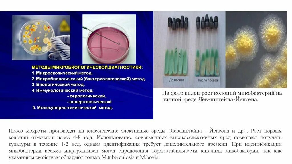 Мокроту для бактериологического. Микобактерия туберкулеза бактериологический метод. Бактериологическое исследование микобактерий туберкулеза. Рост микобактерий на среде Левенштейна Йенсена. Культуральный метод исследования фтизиатрия.