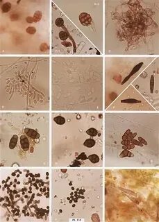 Candida в кале