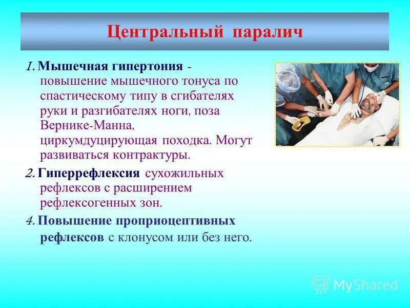 мышечная гипертония