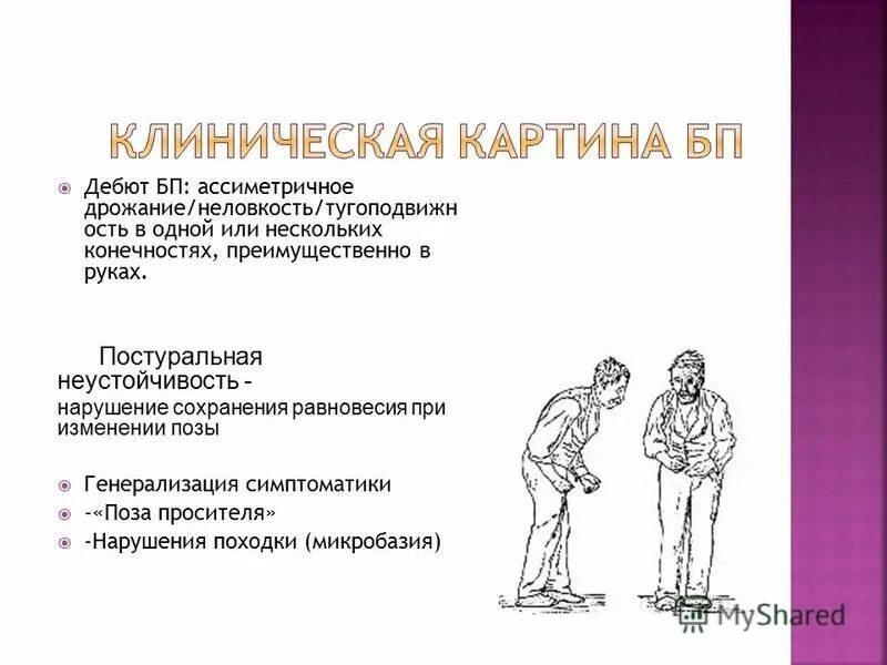 постуральная неустойчивость это