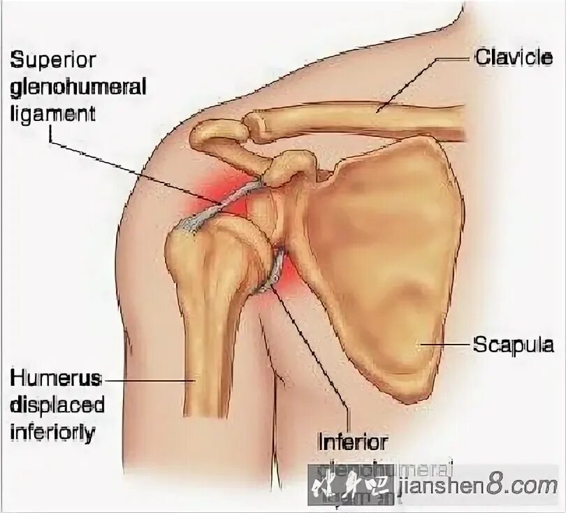 Лестничные мышцы и плечевое сплетение. Точечный массаж грудины. Воспаленный надключичный лимфоузел. Отдает в правую ключицу. Отдает в правую ключицу.
