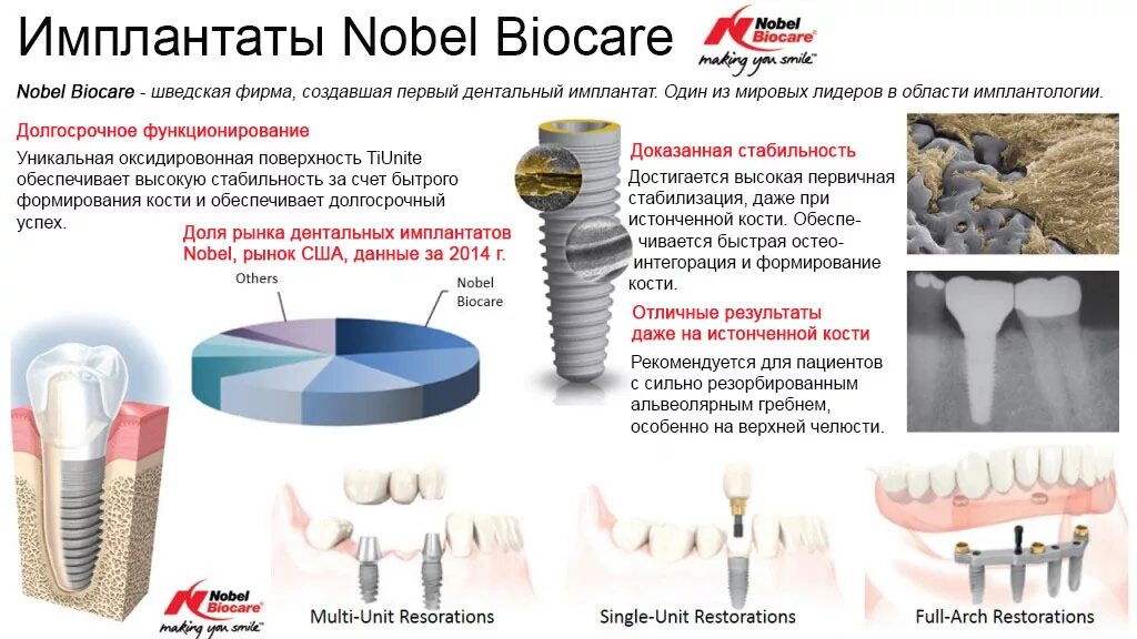 Имплантация sup aznona com. Имплант системы Nobel Biocare. Имплант зуба Nobel Biocare. Имплантация Nobel Biocare производитель. Нобель Биокеар импланты производитель.