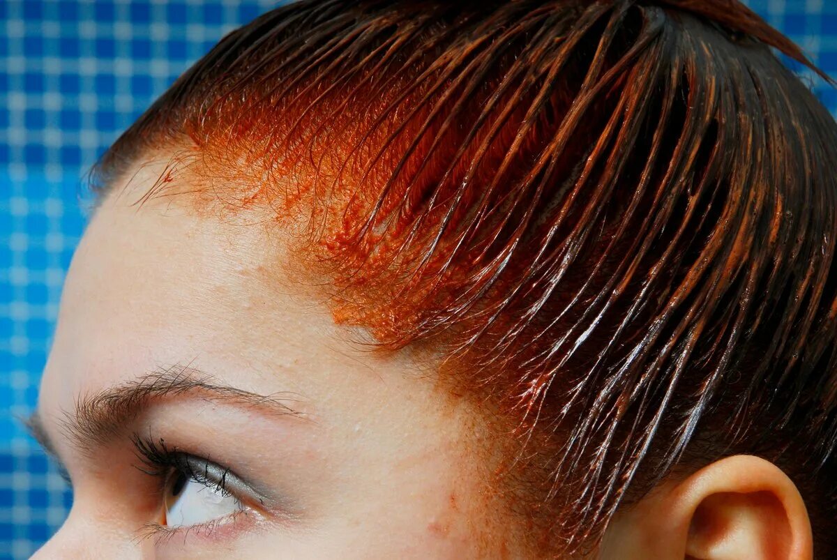 Выпадают после покраски. Пигментация волос на голове. Окрашивание головы хной. Хна для волос.. Хна от краски для волос.