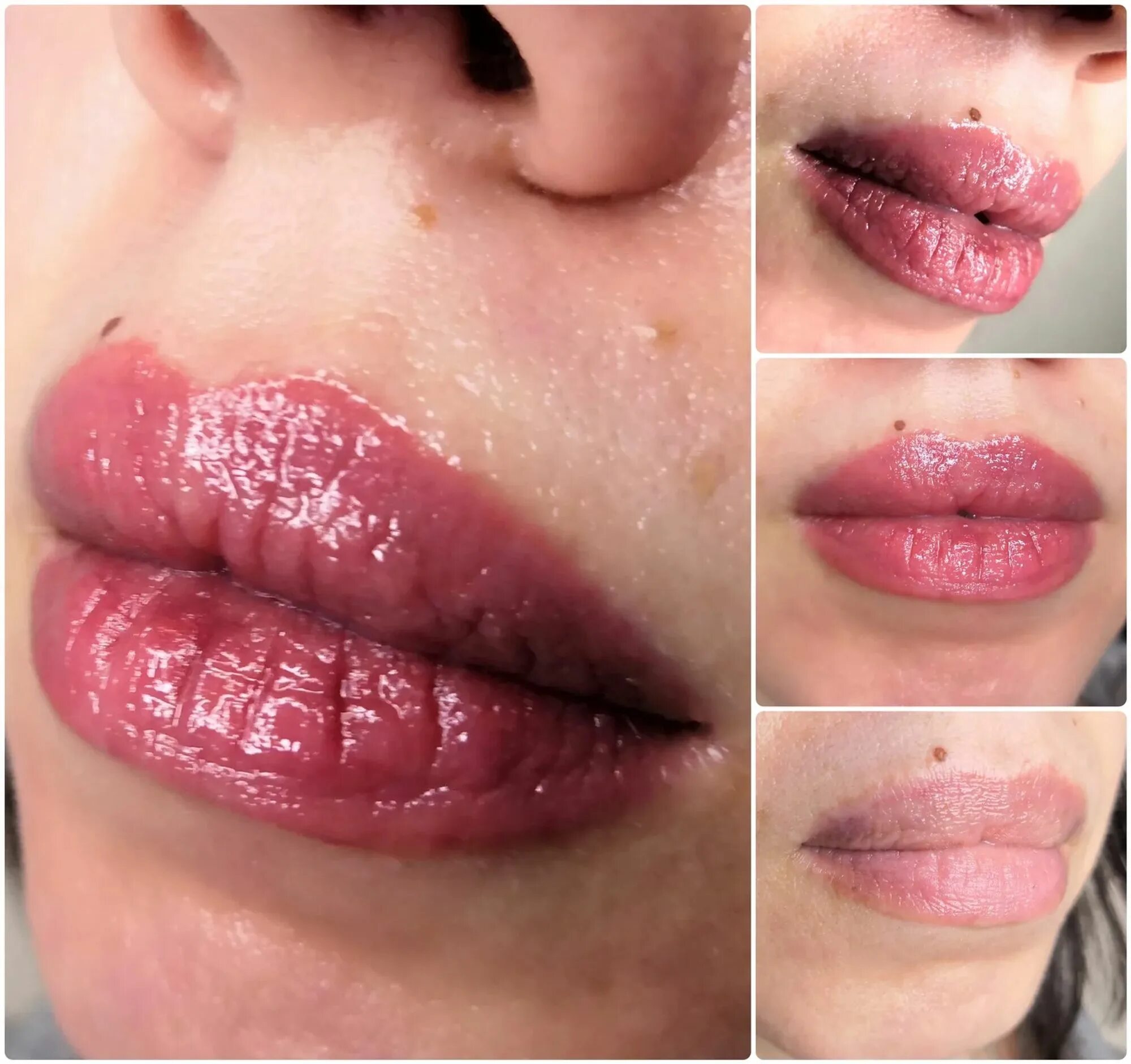 Некачественный татуаж губ. Сведение ремувером татуажа губ зажившие. Перманентный макияж губ. Перманент губ до и после. Удаление ремувером губы.