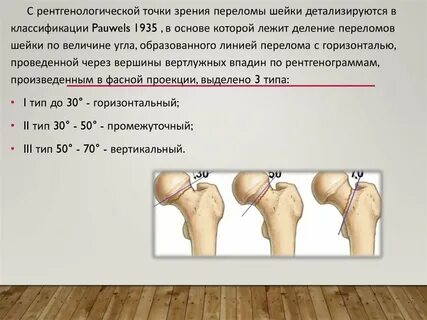 Симптомы перелома шейки
