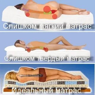 Остеохондроз какой матрас лучше