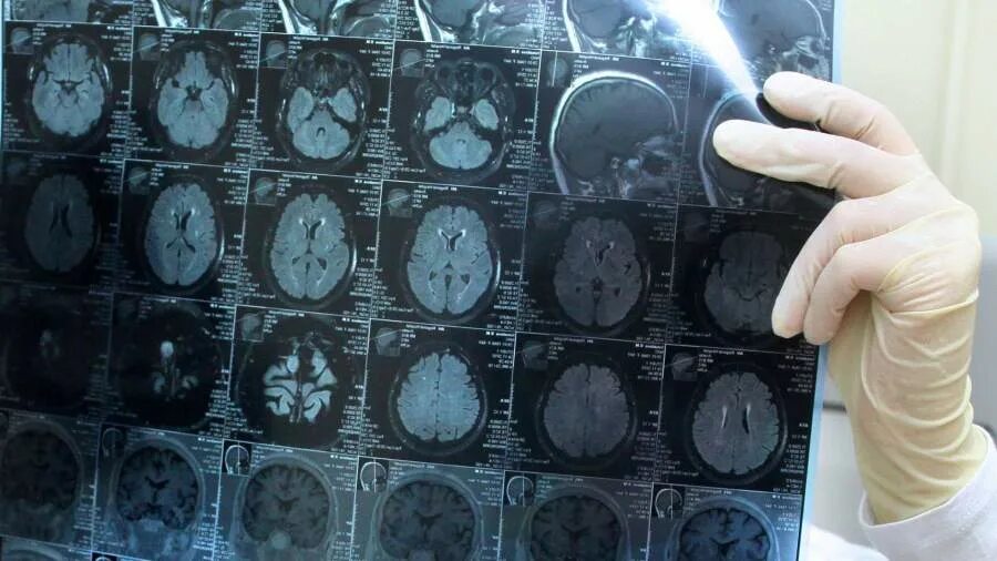 день опухоли мозга