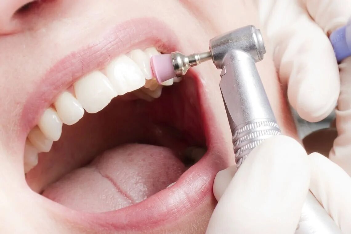 ультразвук полости рта