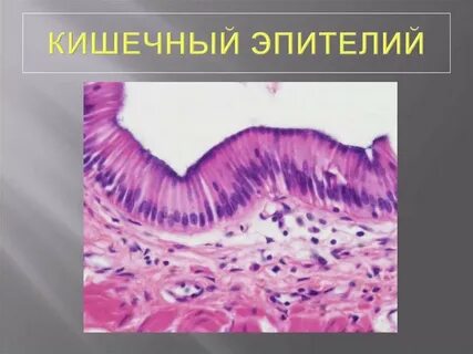 Эпителий ворсинок кишечника