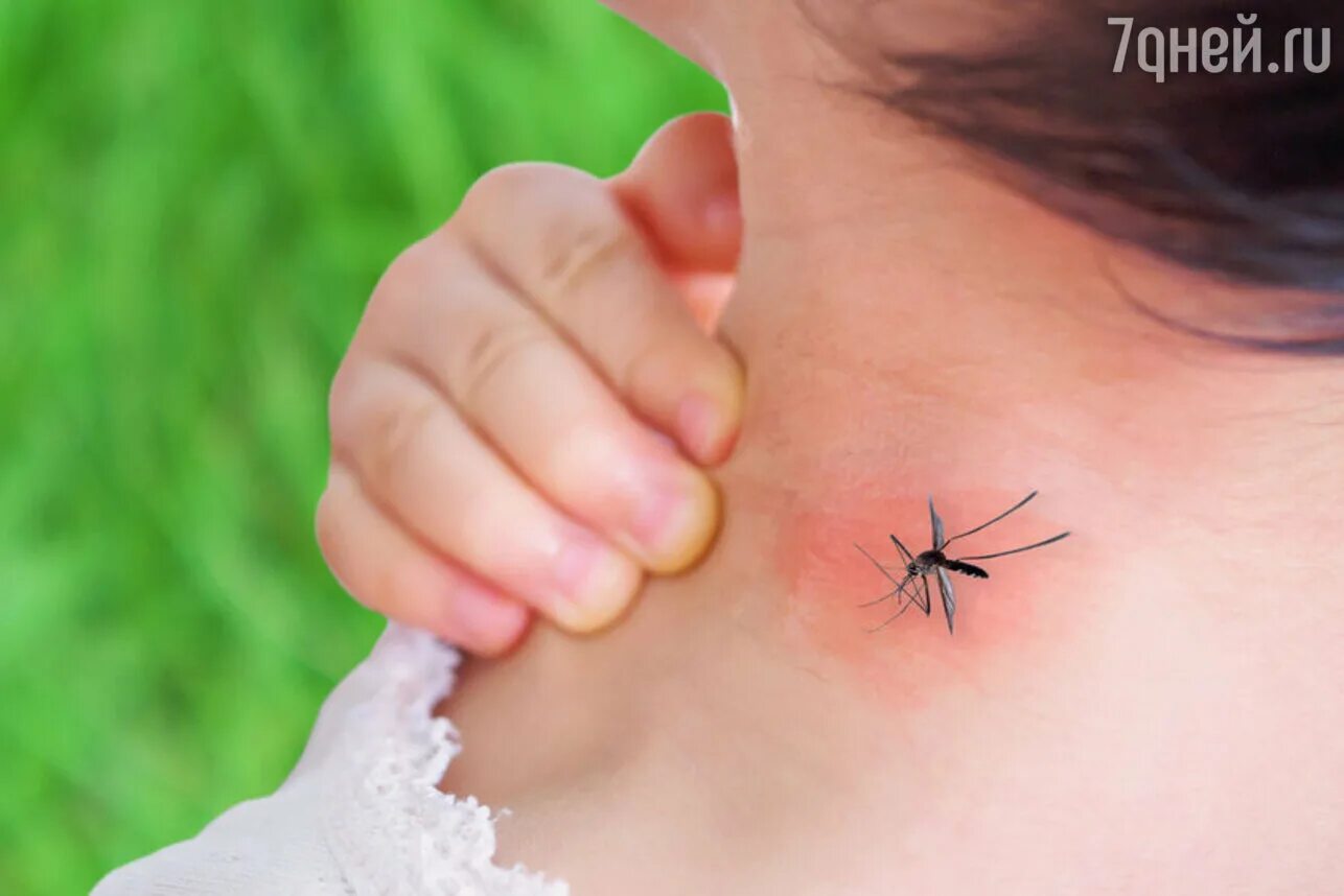 Комар кусачий с двумя полосками. Насекомые которые кусаются. Aedes aegypti комар. Сон укусы комарами. Сон укусы комарами.