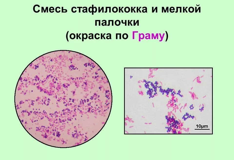 Биоаугментация почв. Опыт гриффитса. Firmicutes бактерии. Смесь микроорганизмов. Условно патогенные микробы.