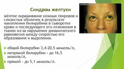Выраженные желтые тела