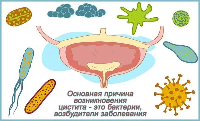 Возбудители цистита у детей. Парить ноги при цистите. Прогревание при цистите у женщин. Можно ли греть ноги при цистите. Цистит можно греть ноги