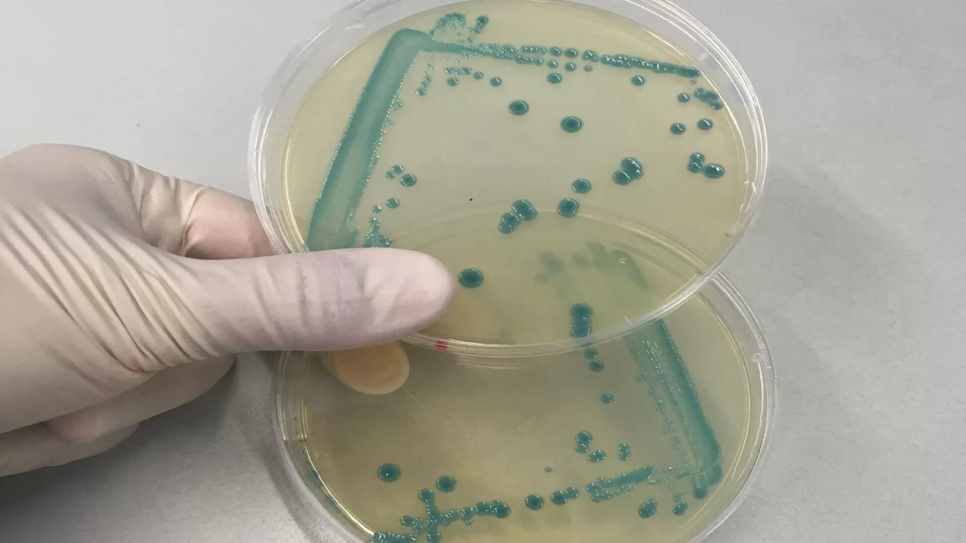 Listeria rj. Листерии микробиология. листерии моноцитогенес. бактерия listeria monocytogenes. листерия моноцитогенес посев.