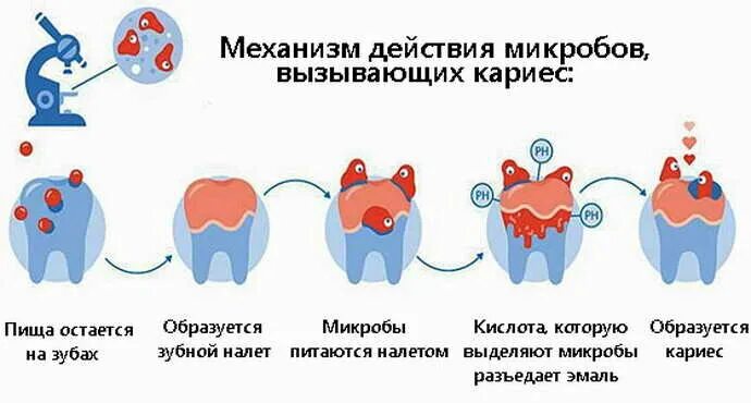 Передается ли кариес поцелуем. Микроорганизмы вызывающие кариес зубов. Бактериальное заболевание кариеса. Стадии образования кариеса. Кариес вызывается бактериями.