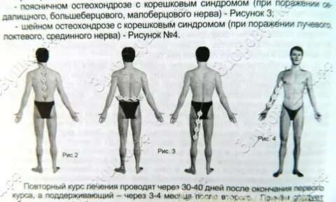 Алмаг куда прикладывать