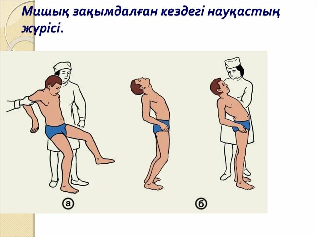 Нарушается координация движения. Атаксия Пьера Мари. Асинергия Бабинского. Статическая мозжечковая атаксия.