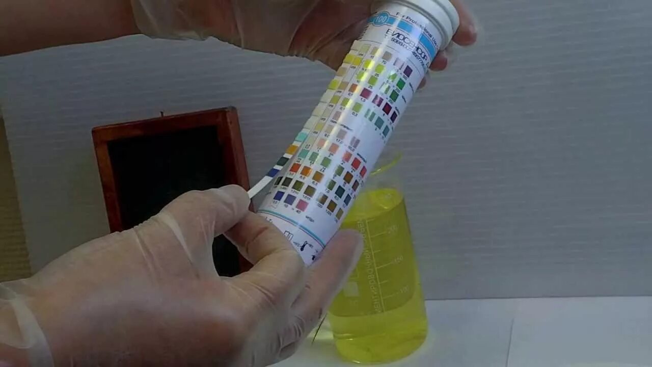 Как проверить мочу дома