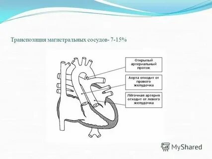 Транспозиция внутренних