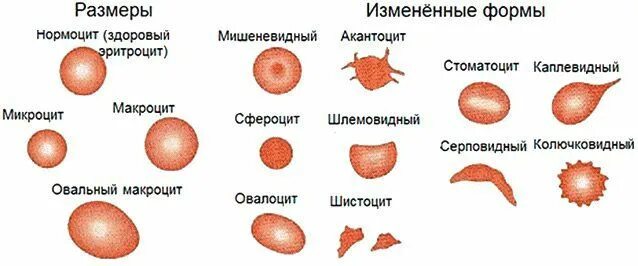 Классификация патологических форм эритроцитов. Возможные изменения морфологии эритроцитов. Нормальные и патологические формы эритроцитов. Патологические формы эритроцитов схема.