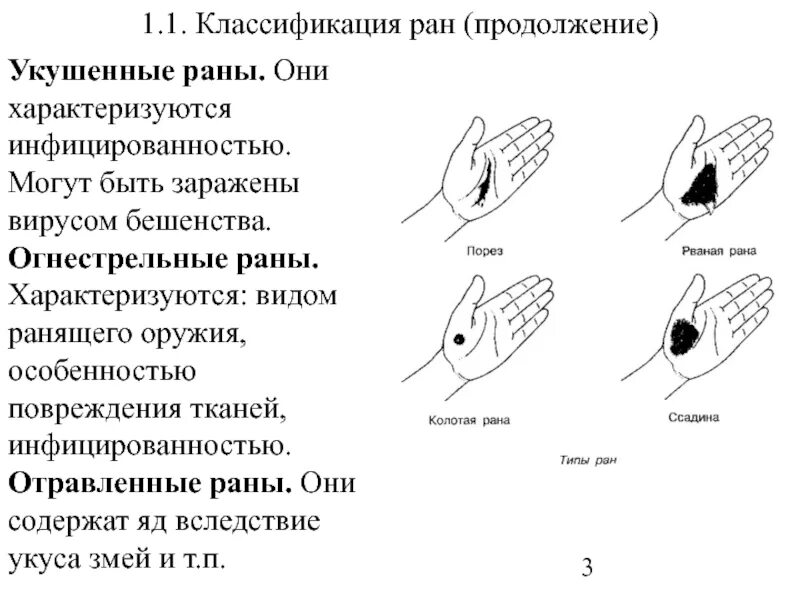 Какие рани есть