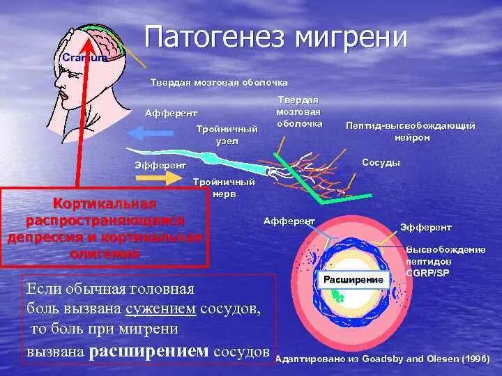 Головная боль сосуды головы. Патогенез мигрени неврология. Патогенез мигрени патофизиология. Патогенез мигрени схема. Патогенез приступа мигрени.