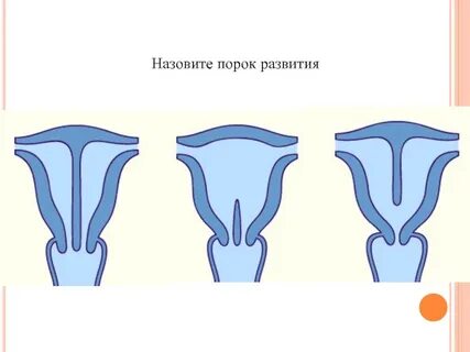 Назовите пороки